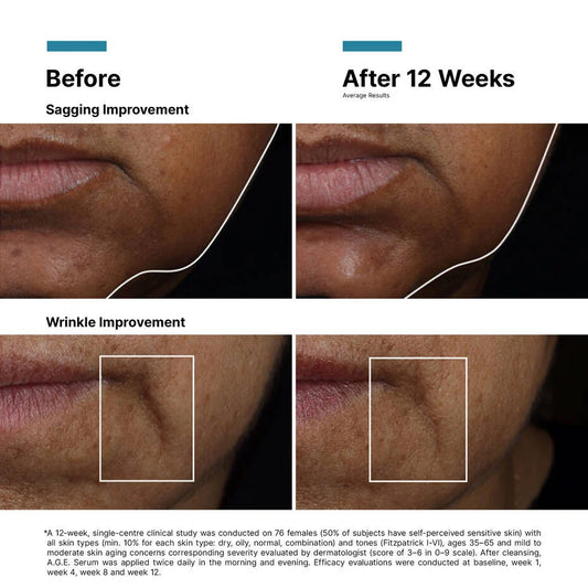 SkinCeuticals A.G.E. Interrupter Ultra Serum