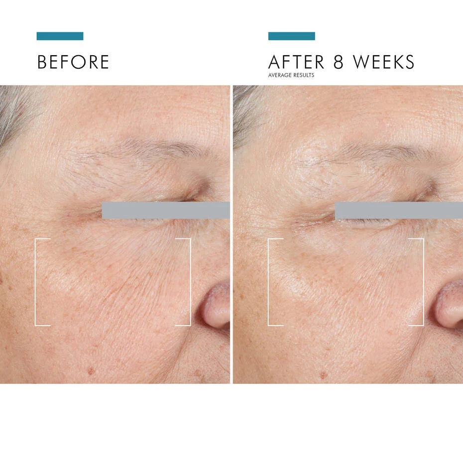 SkinCeuticals A.G.E. Eye Advanced