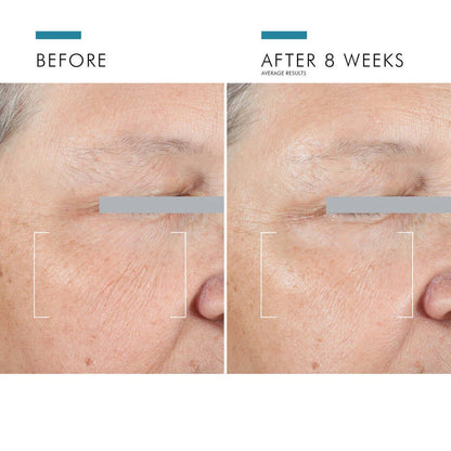 SkinCeuticals A.G.E. Eye Advanced