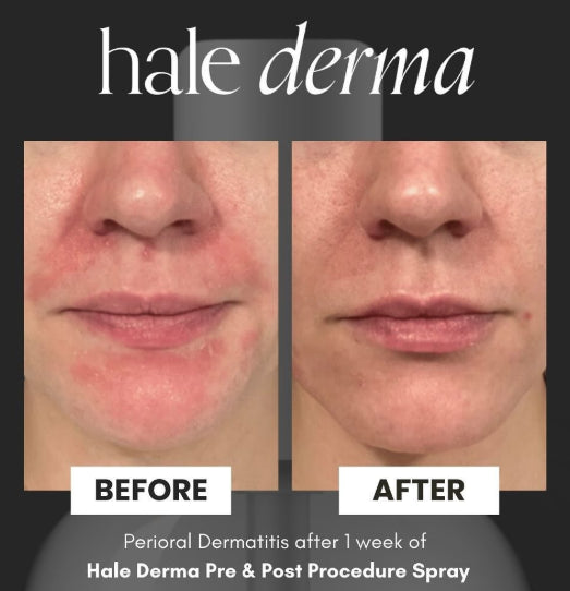 Hale Derma