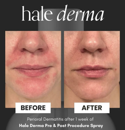 Hale Derma
