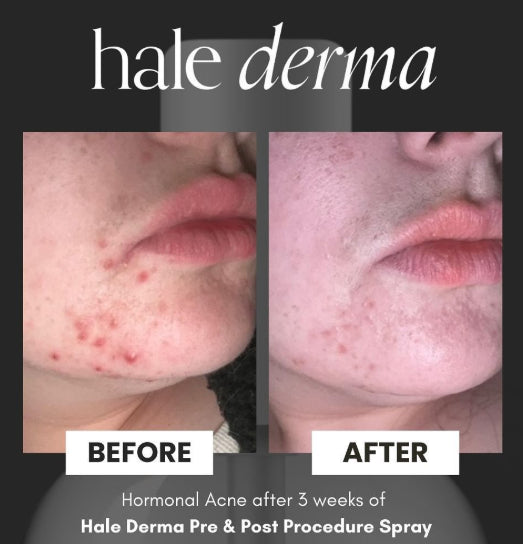 Hale Derma