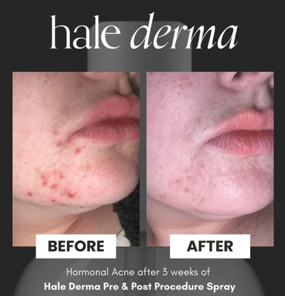 Hale Derma
