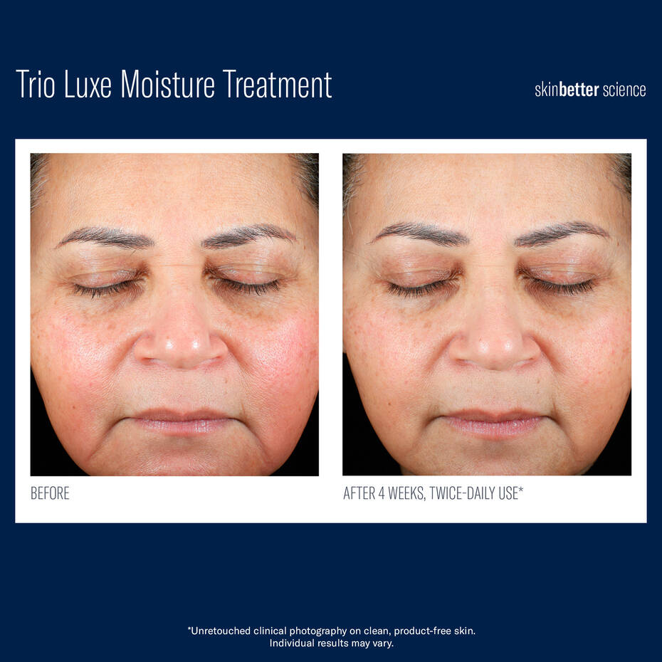 Skinbetter Science Trio Luxe Moisture Treatment