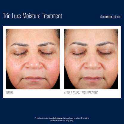 Skinbetter Science Trio Luxe Moisture Treatment