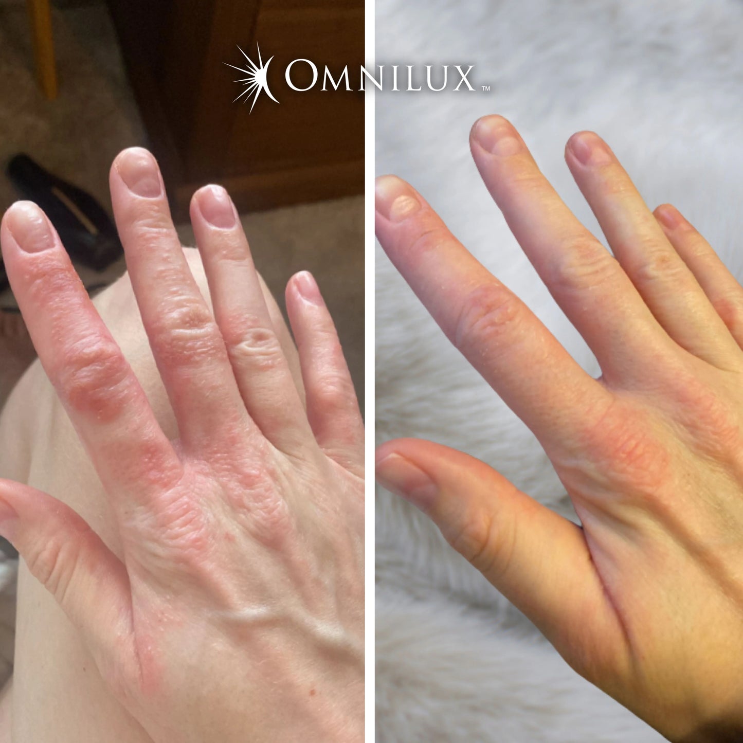 Omnilux Contour Glove