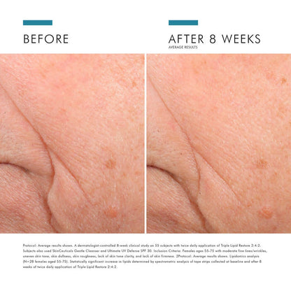 SkinCeuticals Triple Lipid Restore 2:4:2