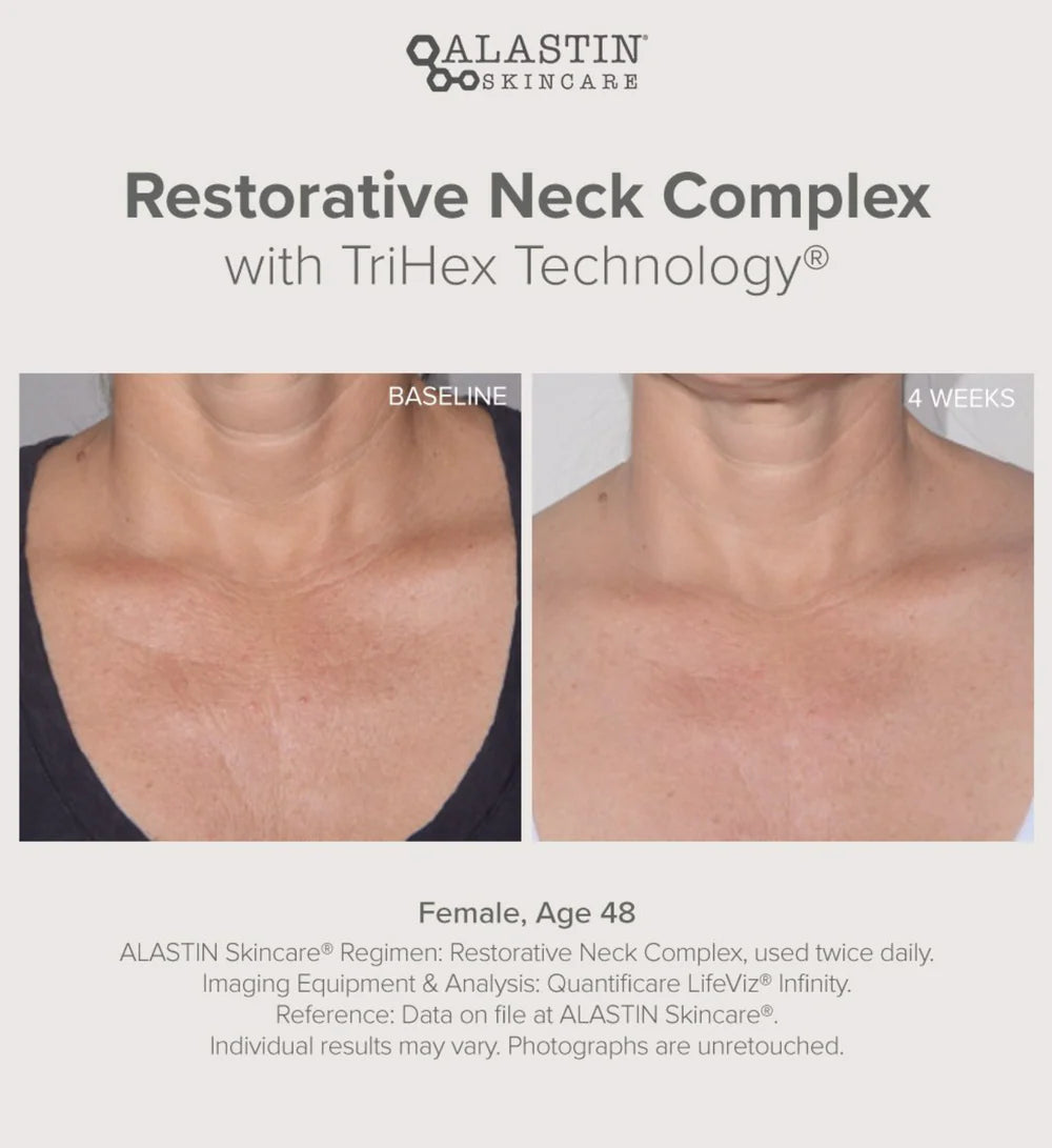Alastin Restorative Neck Complex