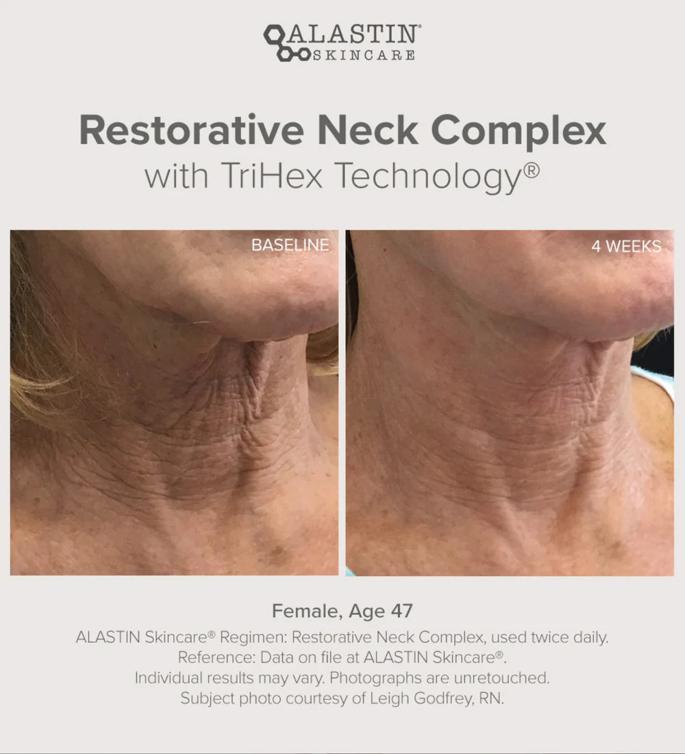 Alastin Restorative Neck Complex