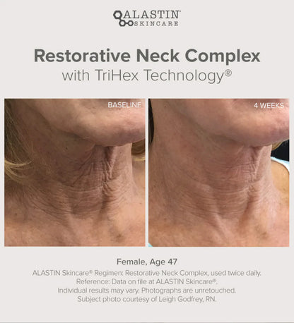 Alastin Restorative Neck Complex