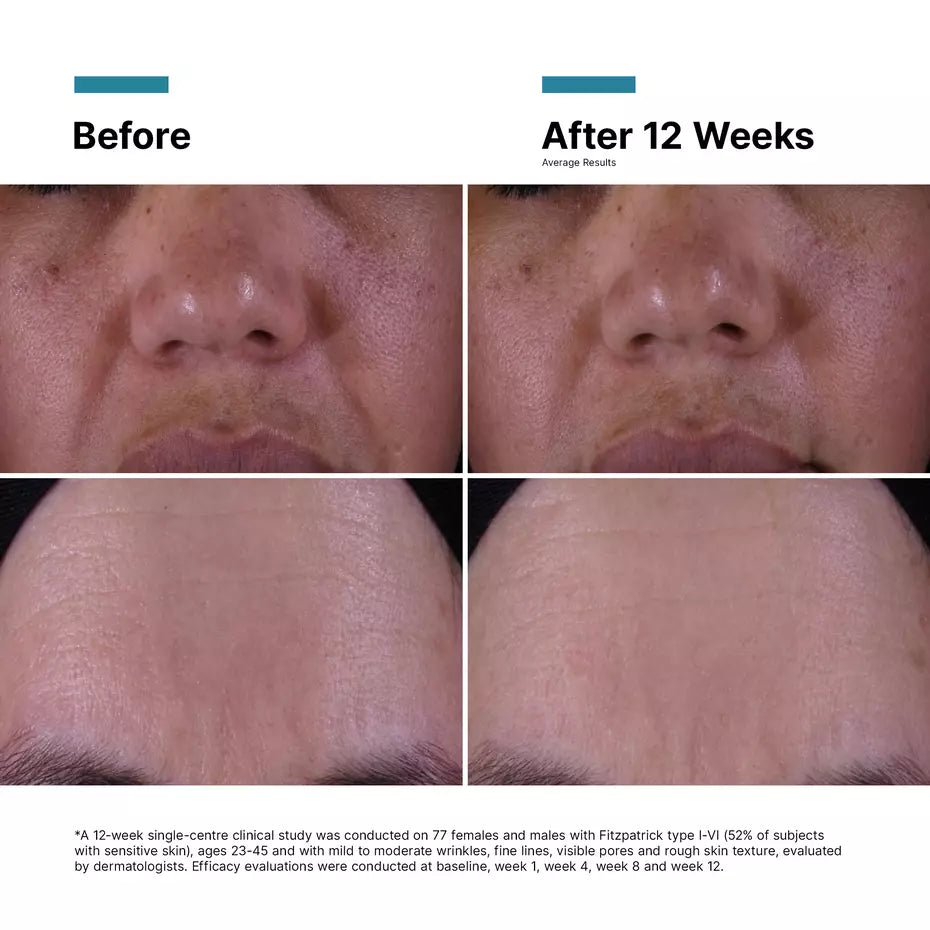 SkinCeuticals P-TIOX Anti-Wrinkle Cream