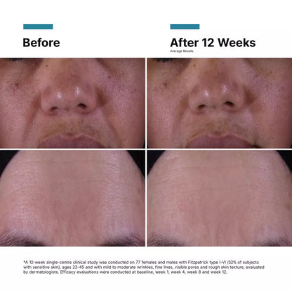 SkinCeuticals P-TIOX Anti-Wrinkle Cream