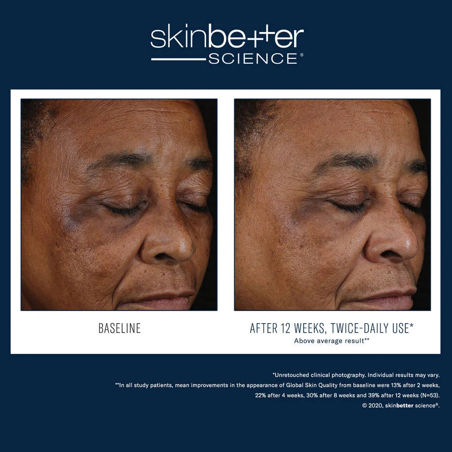 Skinbetter Science Mystro Active Balance Serum
