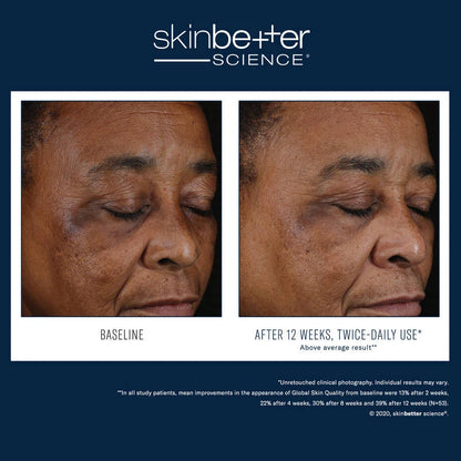 Skinbetter Science Mystro Active Balance Serum
