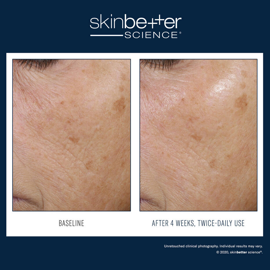Skinbetter Science Trio Rebalancing Moisture Treatment