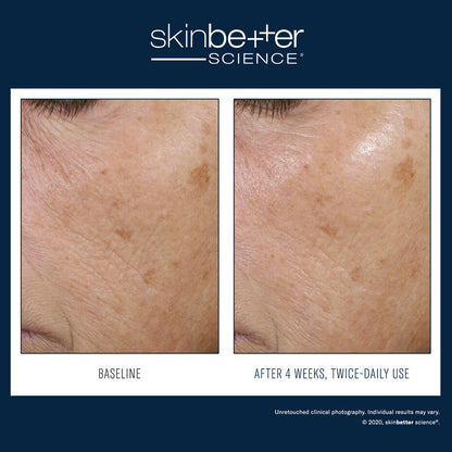 Skinbetter Science Trio Rebalancing Moisture Treatment