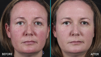 Colorescience All Calm Clinical Redness Corrector SPF 50